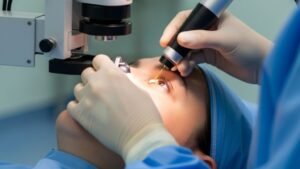 <p>Después de una cirugía de glaucoma con láser, estas son algunas precauciones para evitar lesiones o infecciones.</p>
