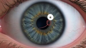 <p>El glaucoma, en sus diversas formas, rara vez presenta síntomas iniciales. Por ello, los chequeos oculares regulares son cruciales.</p>
