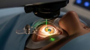 Láser de Femtosegundo: el mejor tratamiento y preciso para eliminar las cataratas