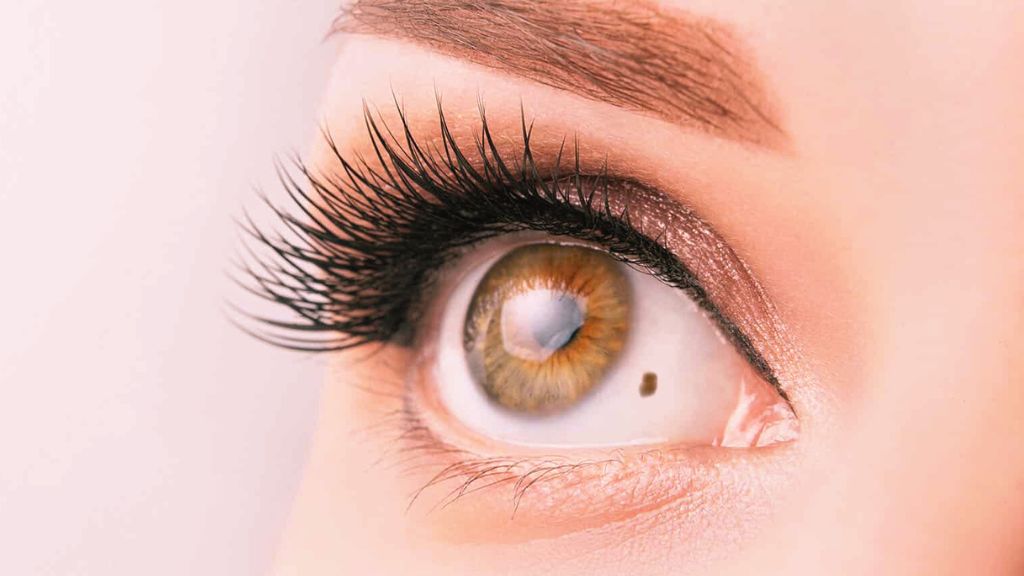 El lunar en el ojo o nevus ocular.