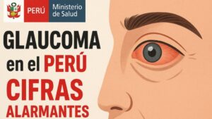 Glaucoma en Perú: cifras alarmantes del MINSA y el plan para blindar su visión
