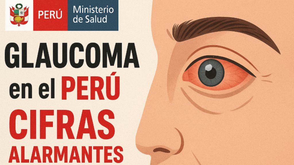glaucoma cifras alarmantes