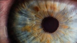 <p>El Síndrome de hipotensión ocular postoperatoria es una complicación poco común pero seria. Conoce sus síntomas, causas y tratamientos para evitar la pérdida de la visión.</p>
